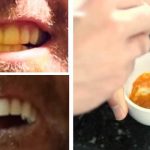 O tonalka que cobre sardas