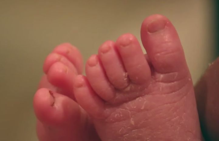O que os médicos encontraram dentro deste bebé, após o parto, deixou-os sem palavras!