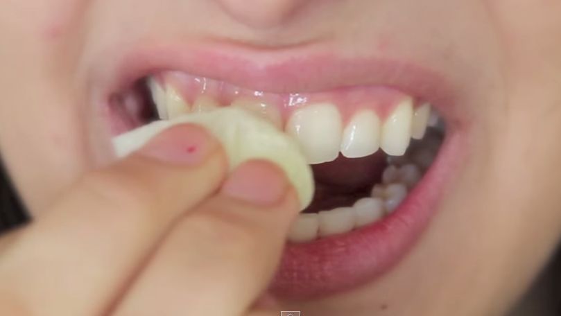Como ficar com os dentes brancos em apenas 2 minutos!