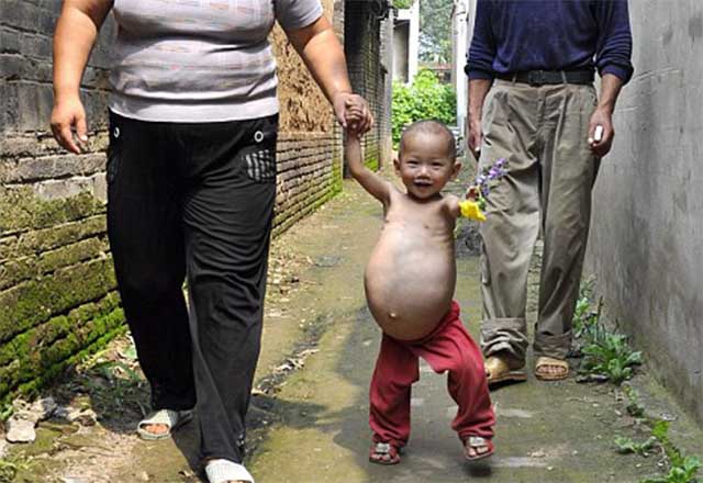 Criança com apenas 1 ano apareceu grávida na China!