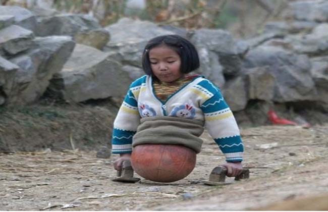 Achas a tua vida miserável? Lê a história inspiradora da menina “basquete”!