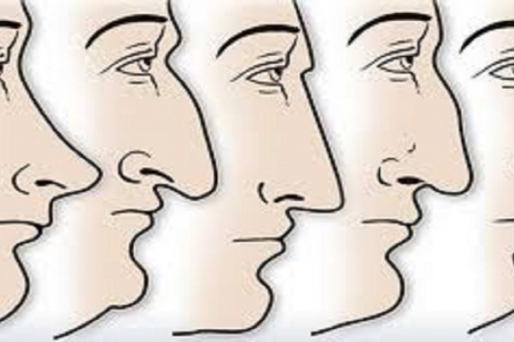 Descobre aqui o que a forma do teu nariz diz sobre ti!