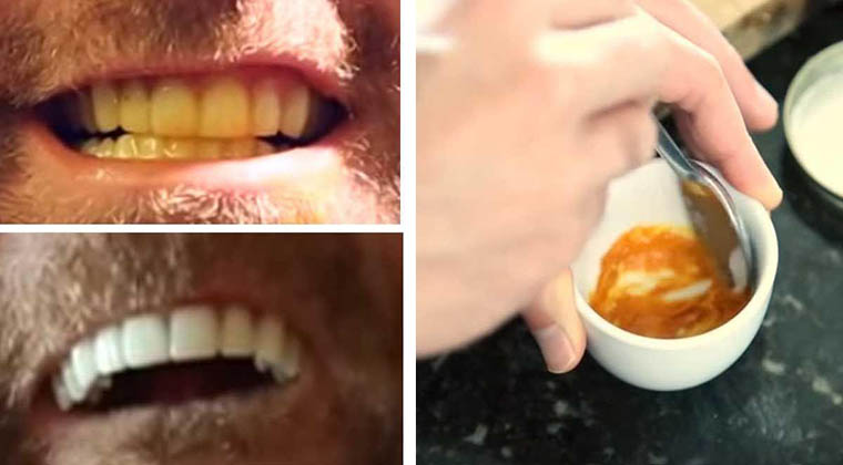 Ele branqueia os dentes com um truque tão simples… Apenas precisa de uma pasta e este ingrediente…