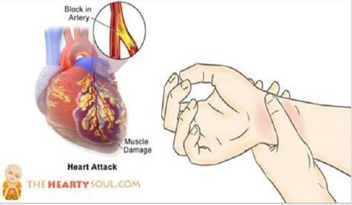 80% dos ataques cardíacos podem ser evitados com estes segredos naturais!