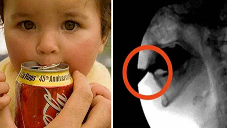 Médicos de todo o mundo estão a alertar os pais para que não deixem os filhos beber Coca-Cola!