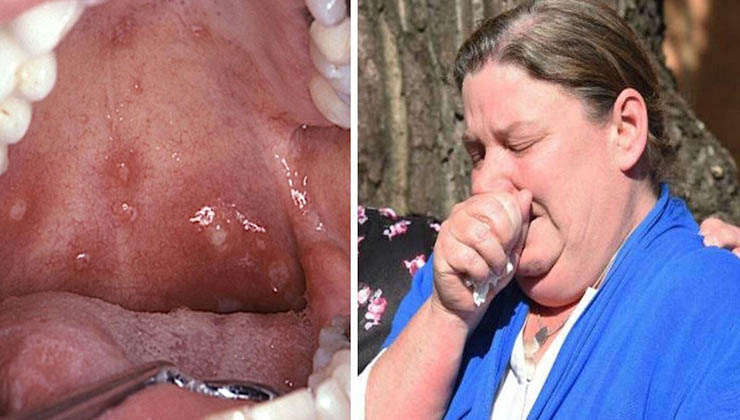 A sua filha de 10 anos morreu subitamente… O que os médicos lhe encontraram na boca é alarmante!