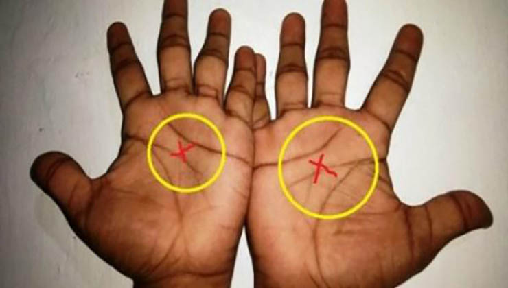 Tens um “X” na palma da mão? Isso é raro! Apenas 3% das pessoas em todo o mundo têm! Sabes o que significa?