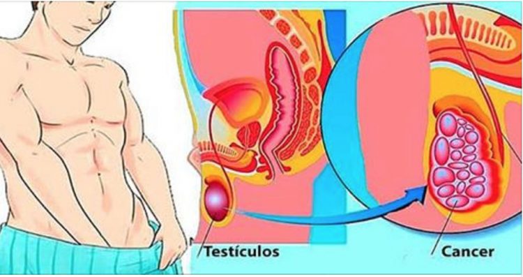 É por esta razão que muitos homens têm cancro nos testículos e nem fazem ideia!