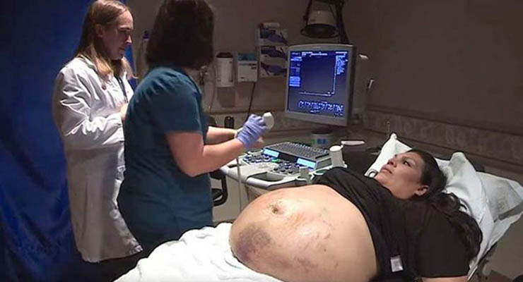 Mãe aparece com hematomas pela barriga toda… Mas quando vêem o ultrassom de perto, todos congelam!